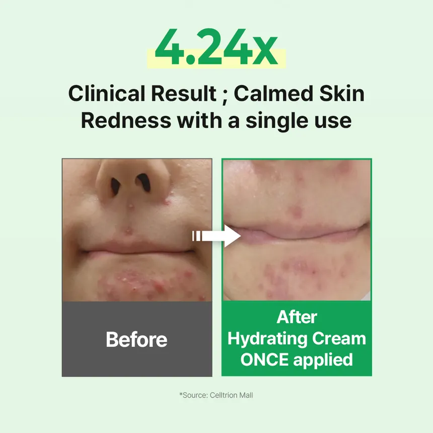 zipiderm - EGF Skin Barrier Hydrating Cream 80ml